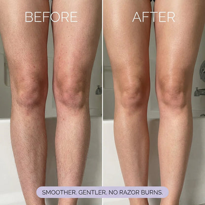 Silqo™ - Painless Hair Removal Mousse