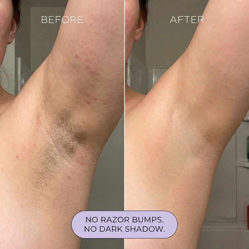 Silqo™ - Painless Hair Removal Mousse