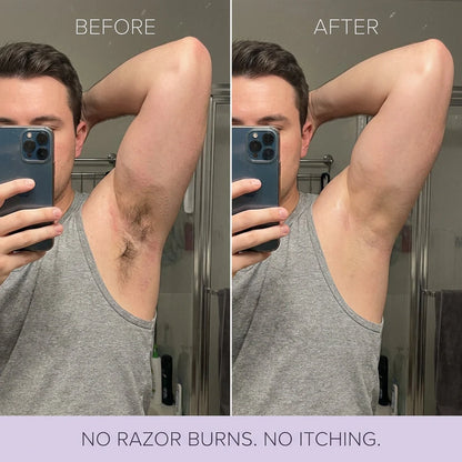 Silqo™ - Painless Hair Removal Mousse